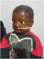 Dummy child with NG tube inserted